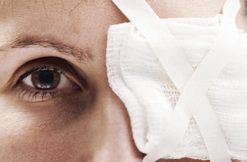 Bulging Eyes: Causes and Treatment Guide